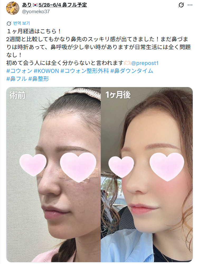 설명