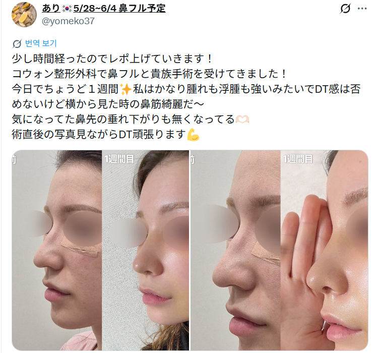 설명
