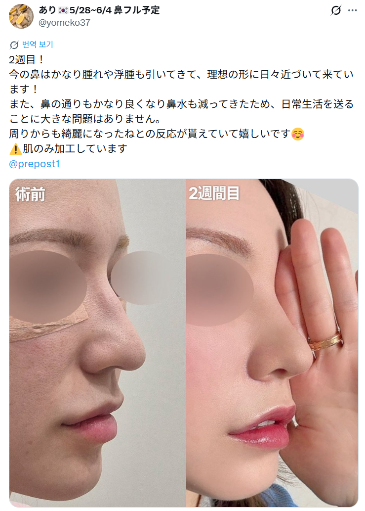 설명