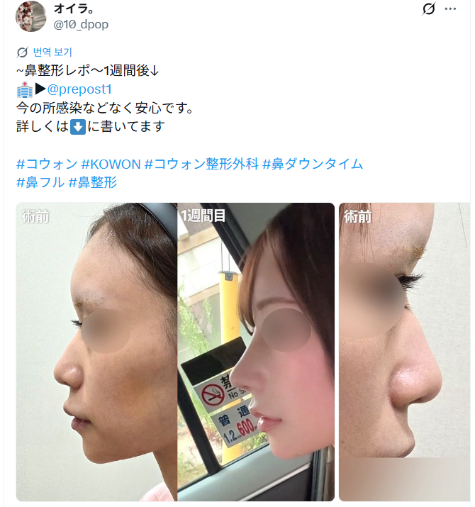 설명