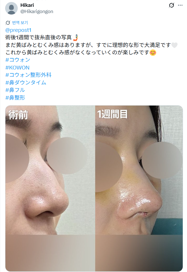설명