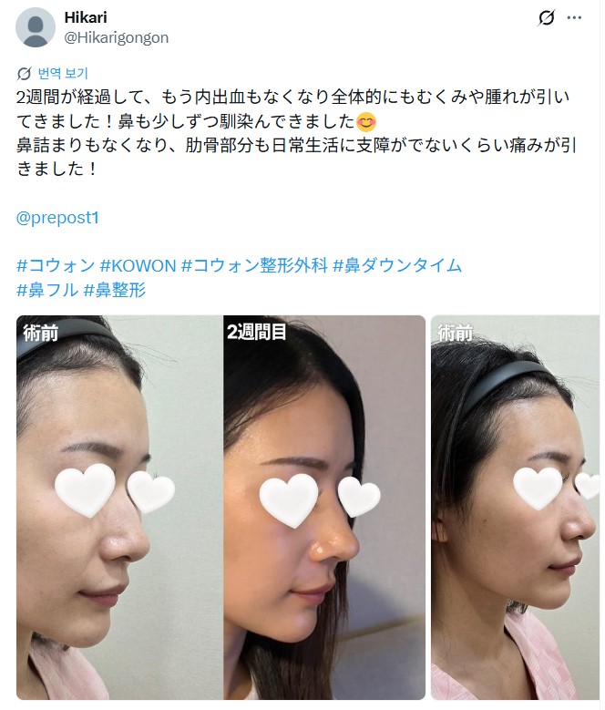 설명