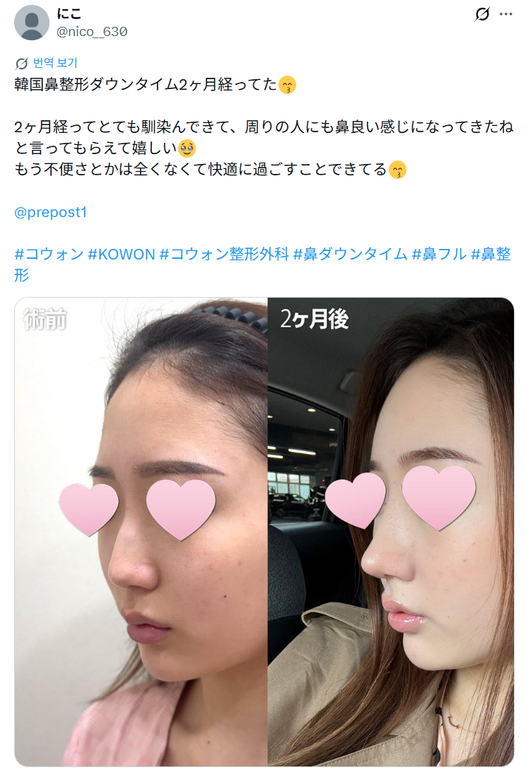 설명