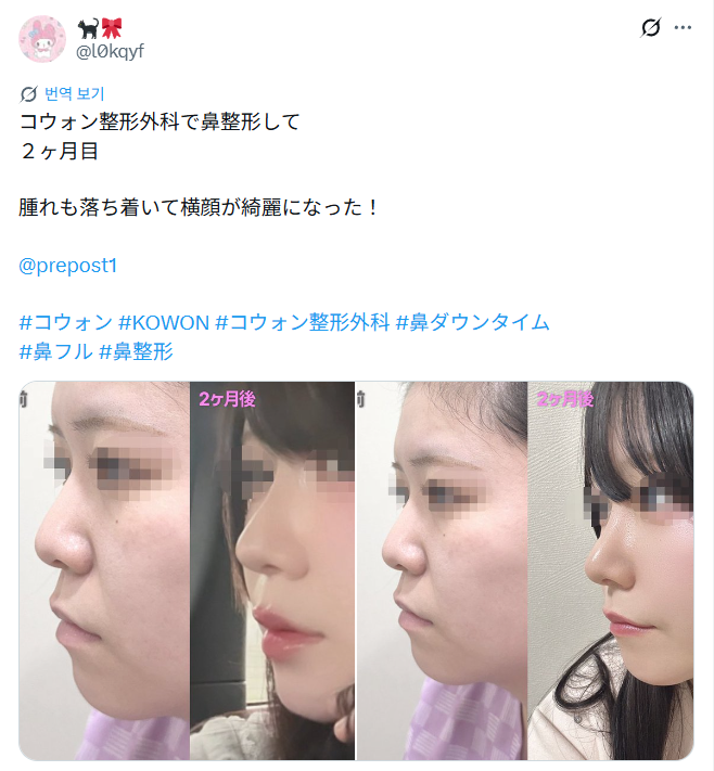 설명