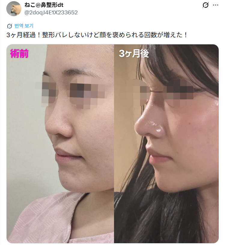 설명