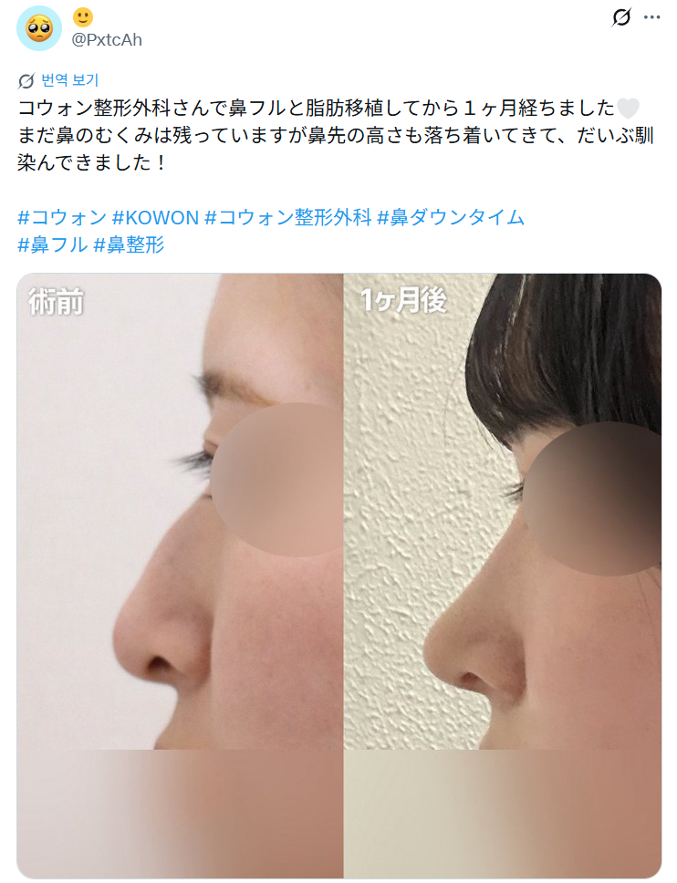 설명