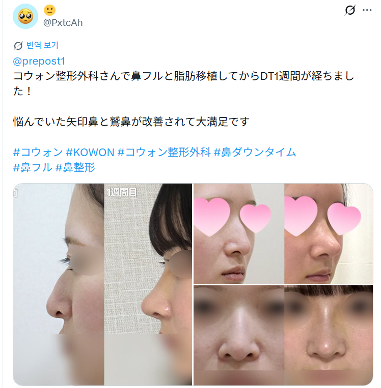 설명