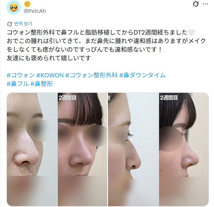 설명