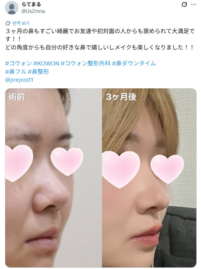 설명