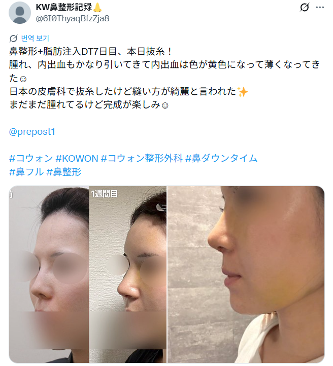 설명