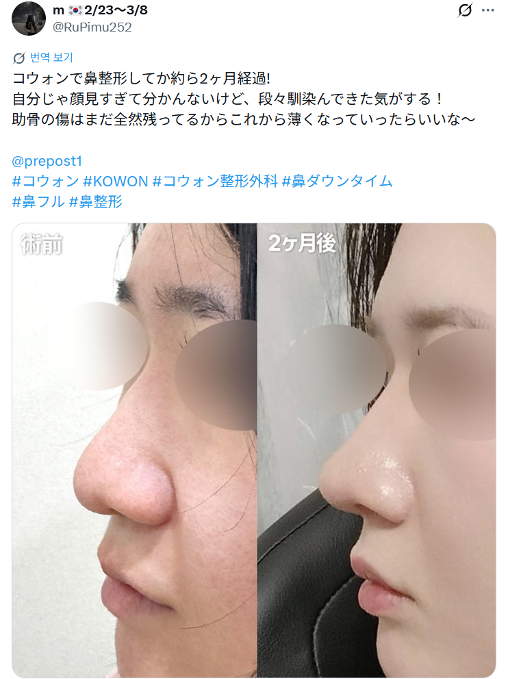 설명