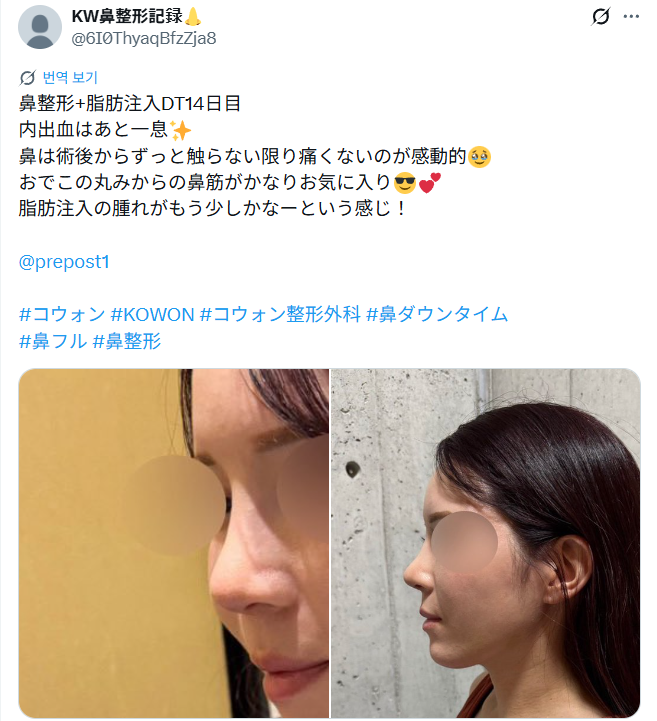 설명