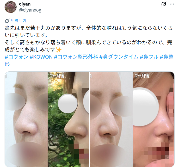 설명