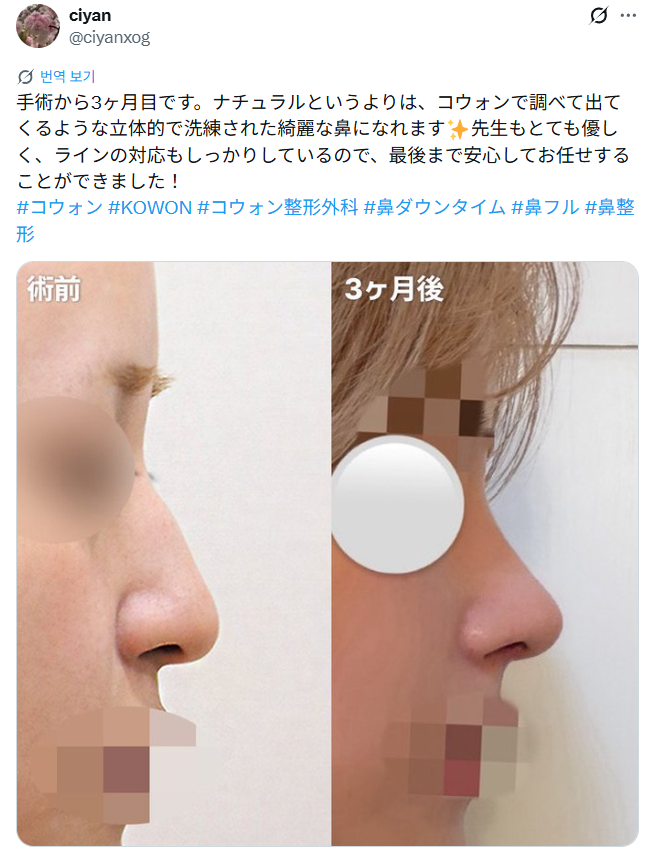 설명