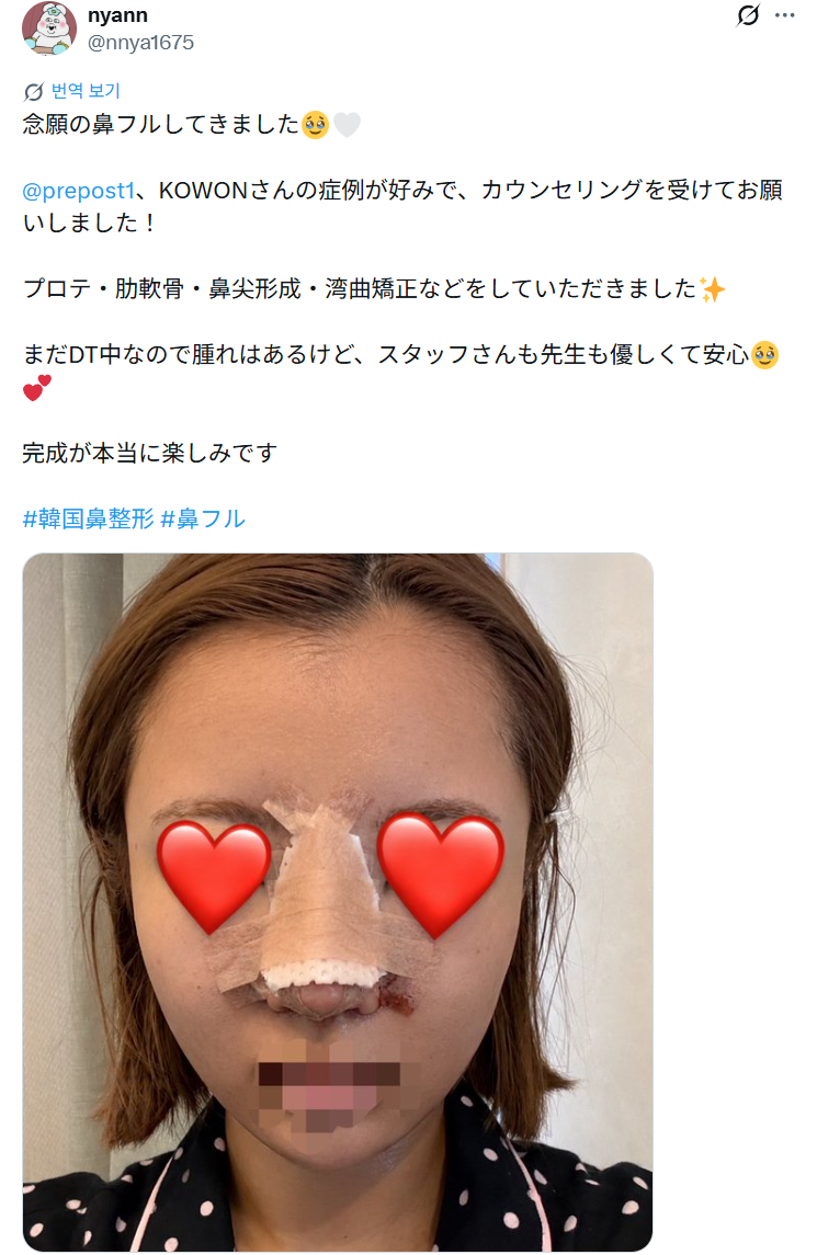 설명
