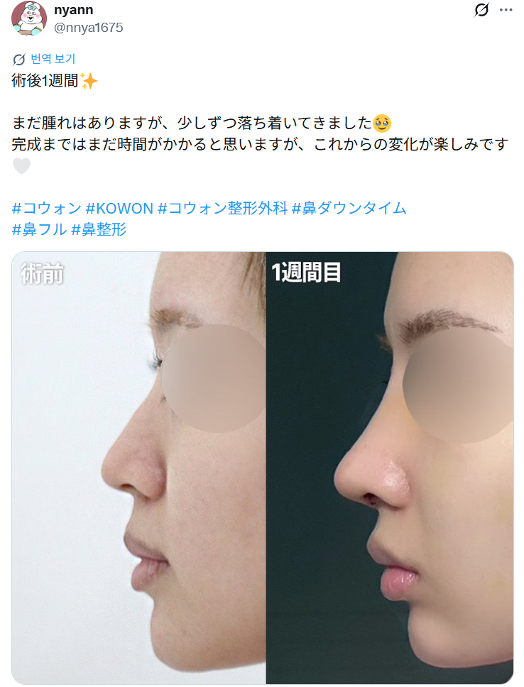 설명