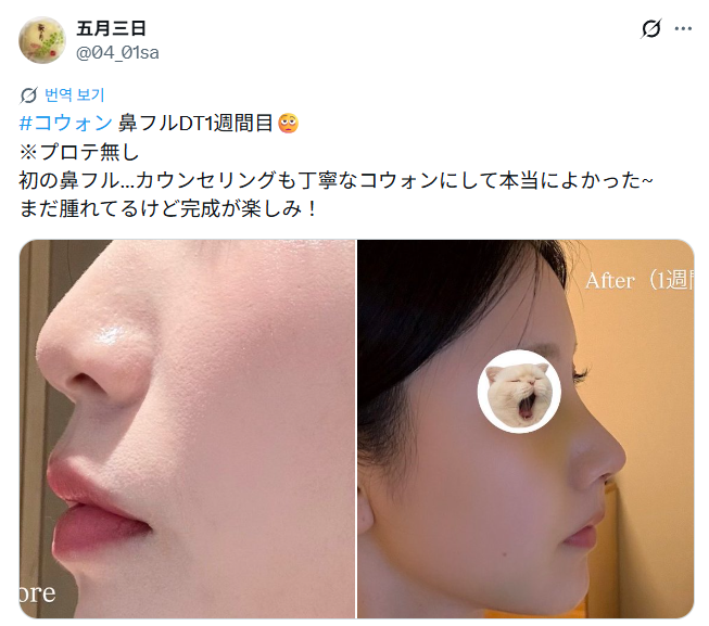 설명