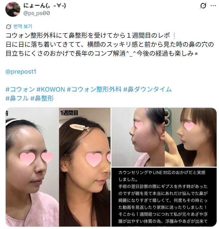설명