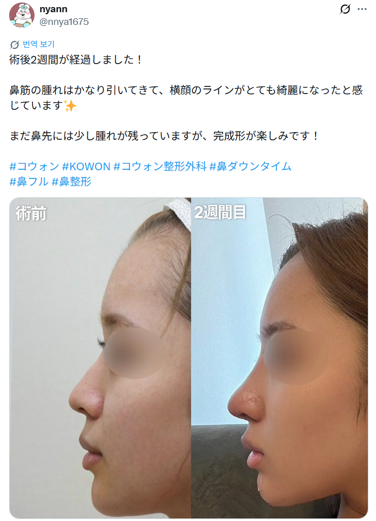 설명
