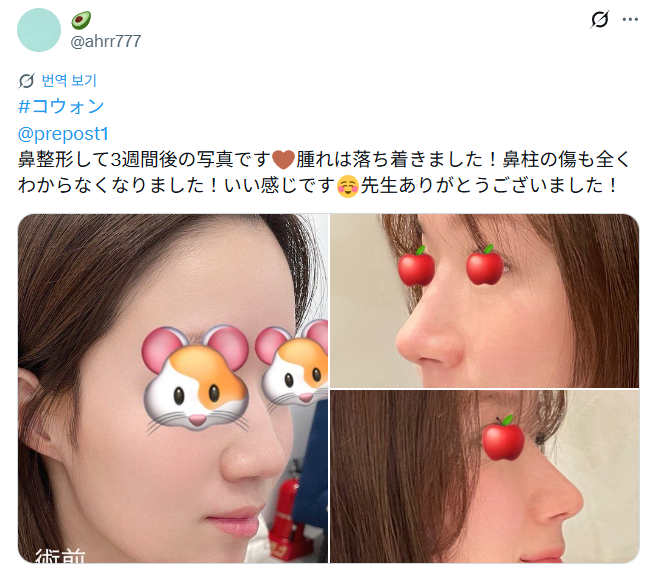 설명