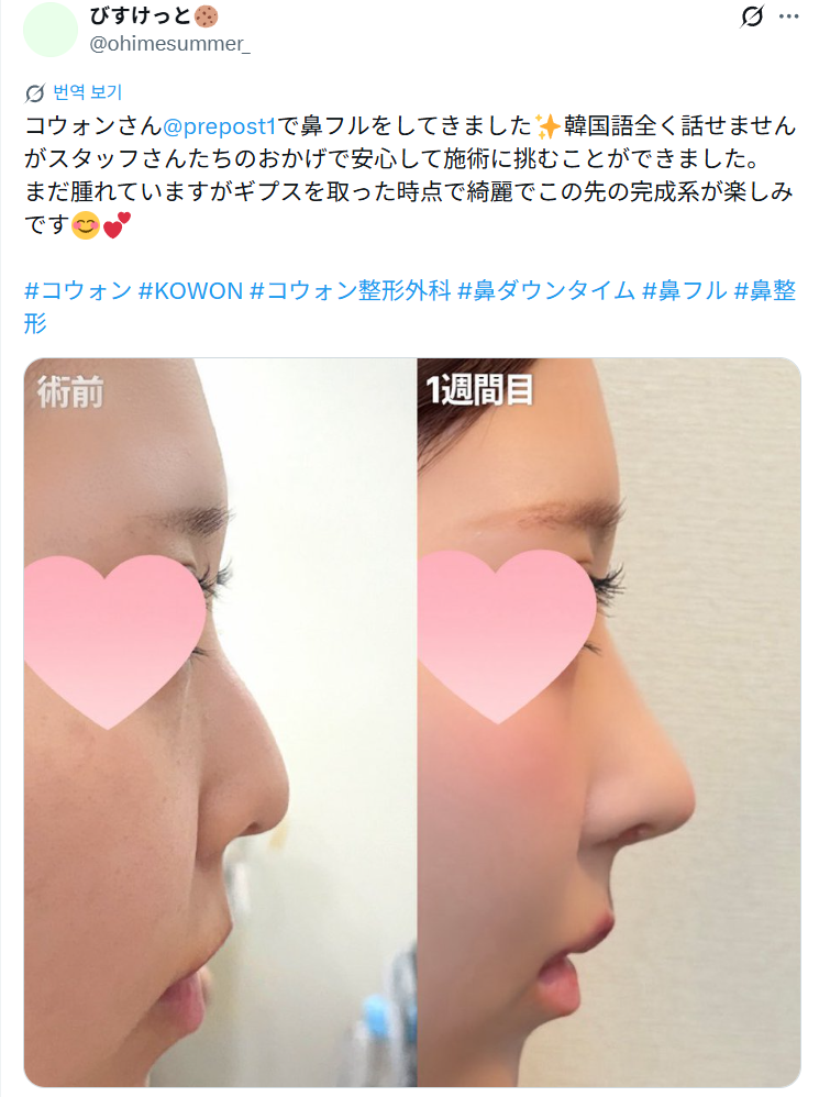 설명