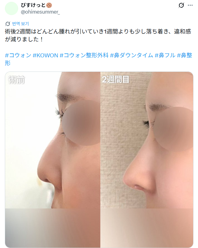 설명
