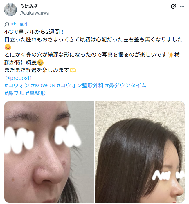 설명