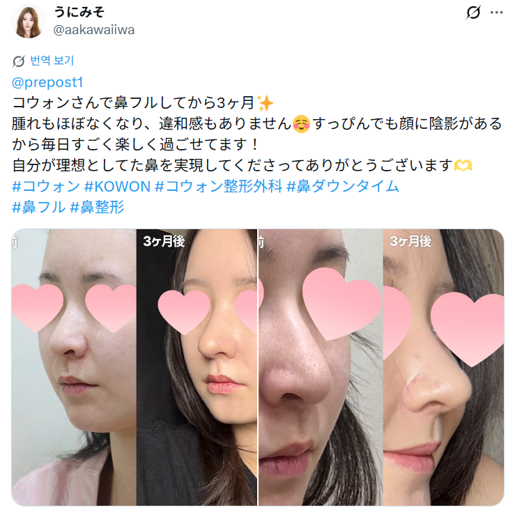 설명