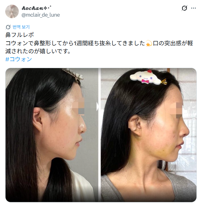 설명