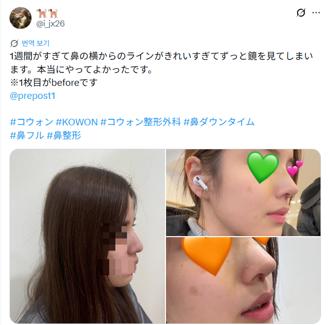 설명
