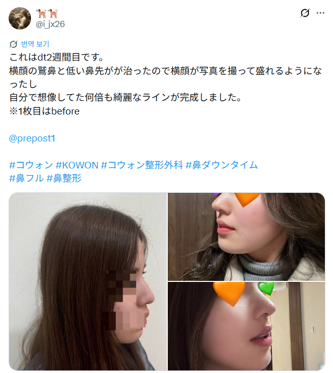 설명