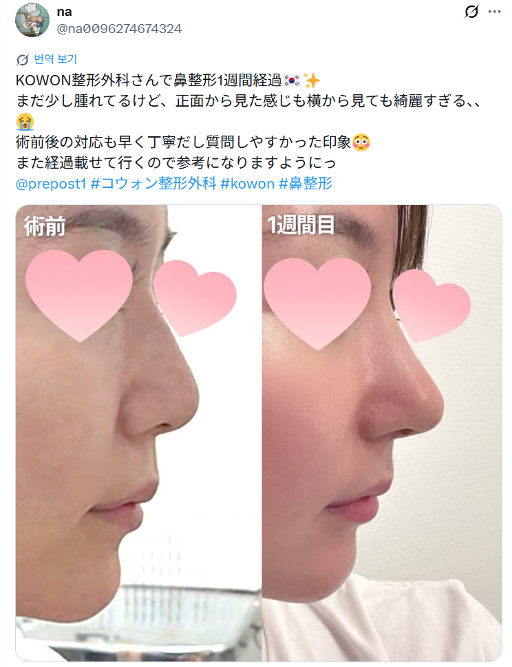 설명