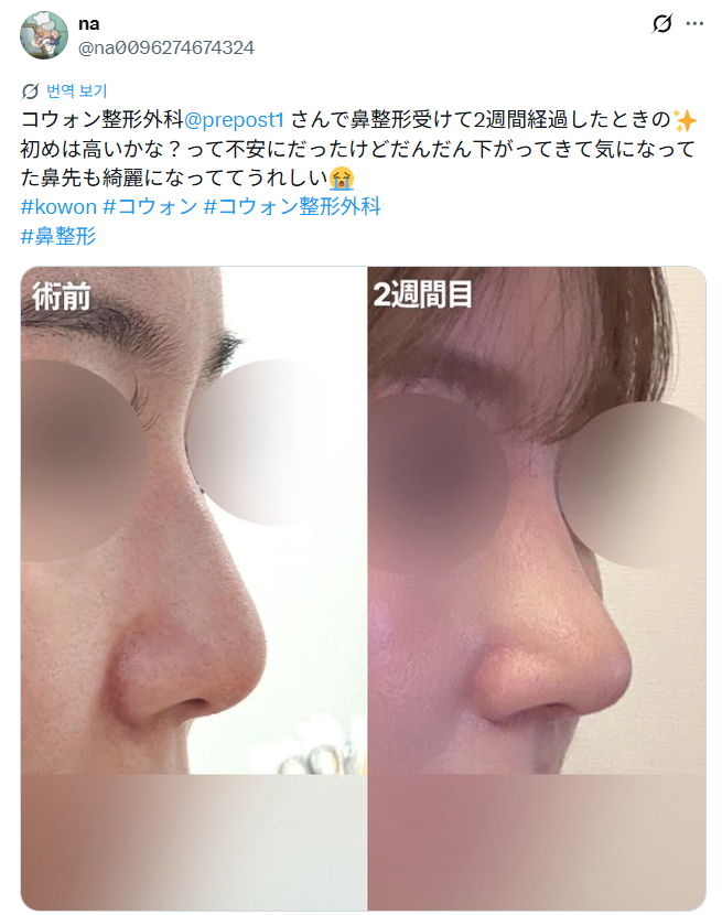 설명
