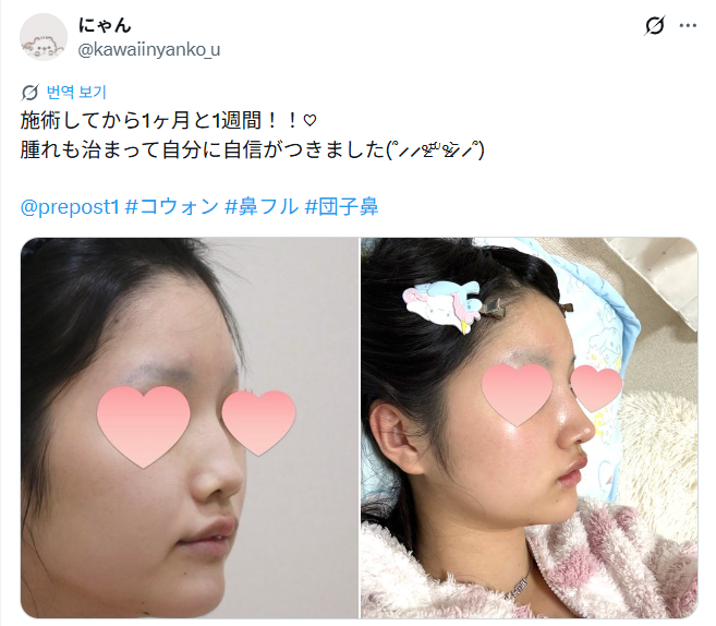 설명