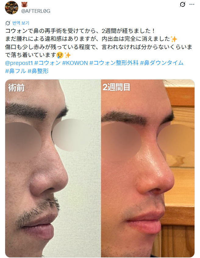 설명
