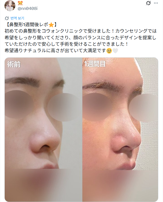 설명