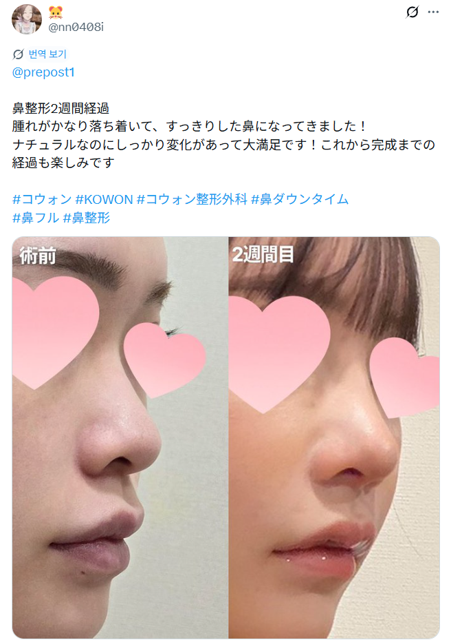 설명