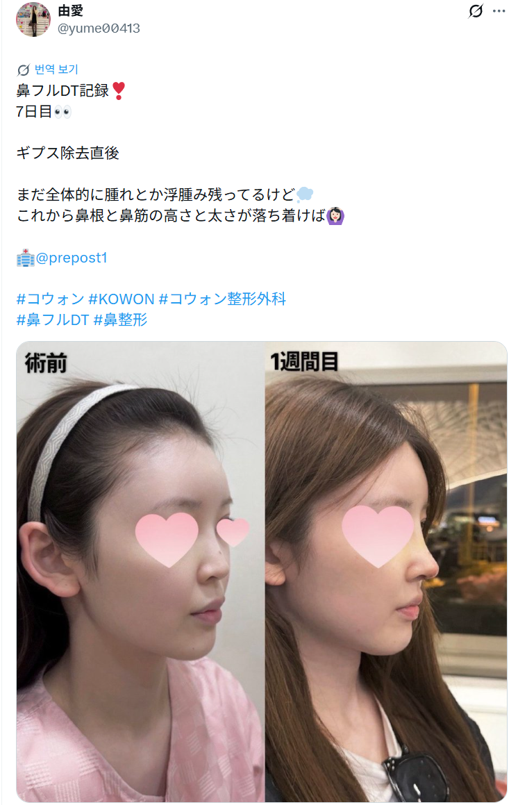 설명