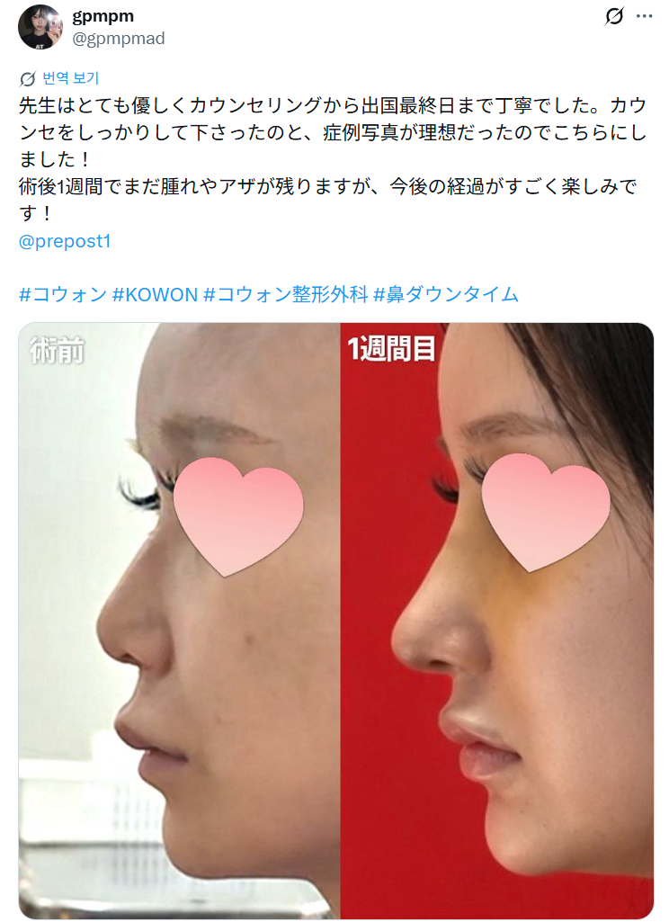 설명