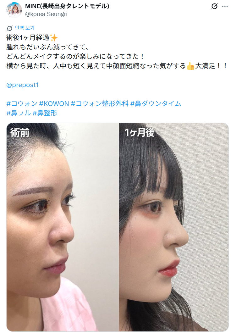 설명