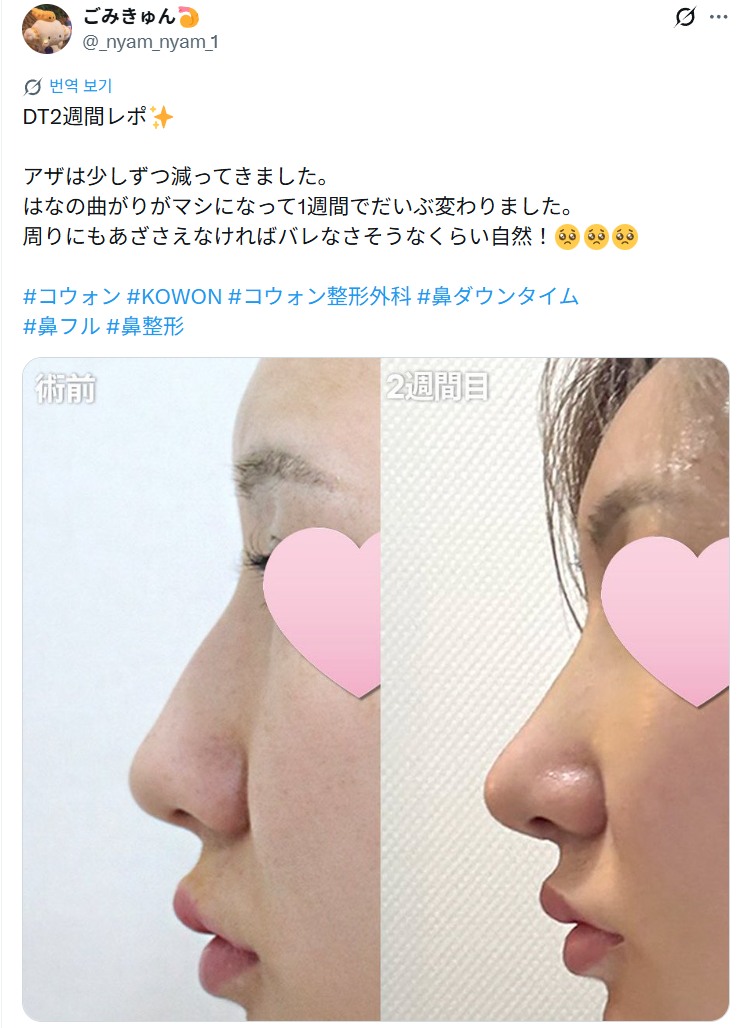 설명