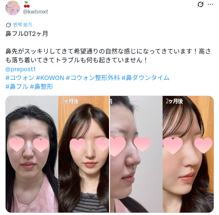 설명