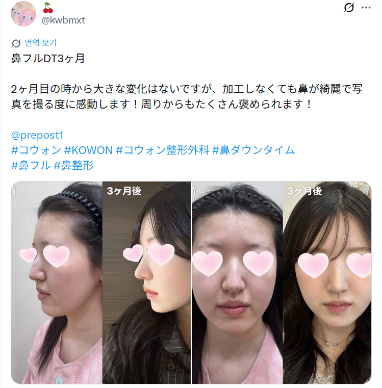 설명