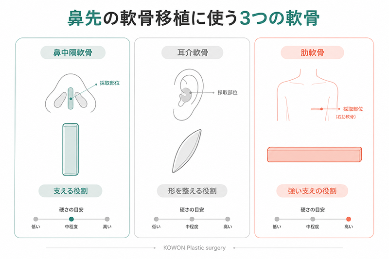 鼻先の軟骨移植に使う3種類の軟骨
