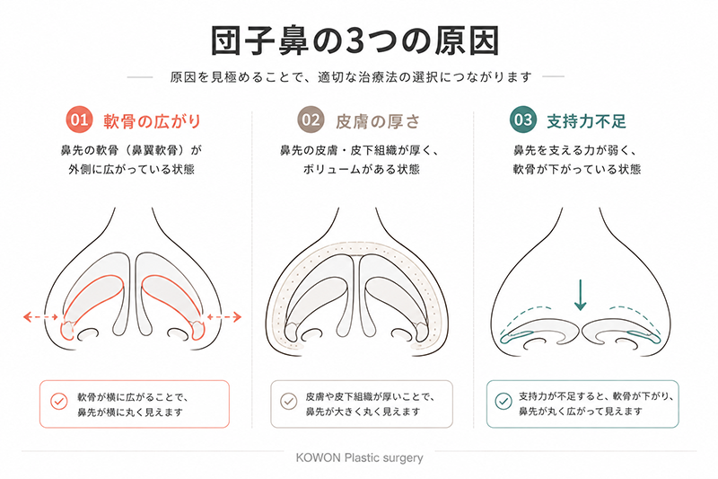 団子鼻の3つの原因