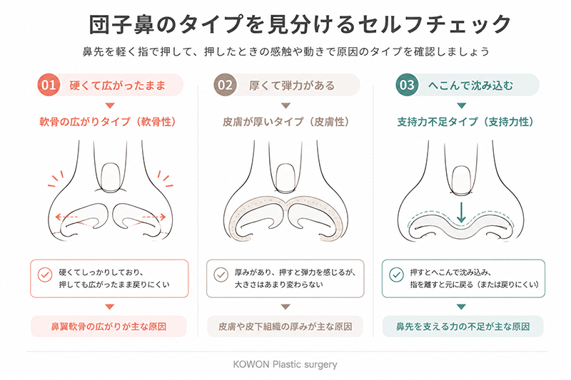 団子鼻のタイプ別セルフチェック