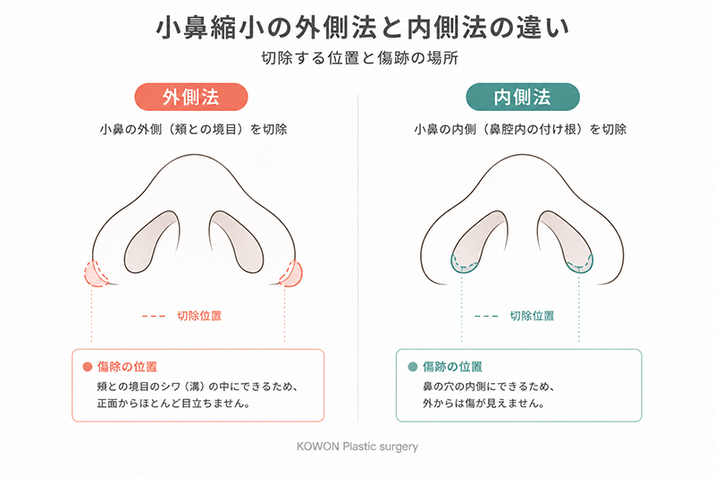 설명